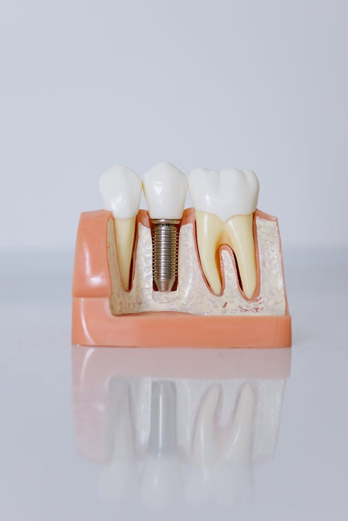 Detailed view of a dental implant model showcasing teeth and gum anatomy for dental education.